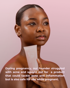 Vhue Skin photo 1
