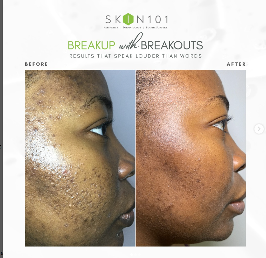 Skin 101 photo 1