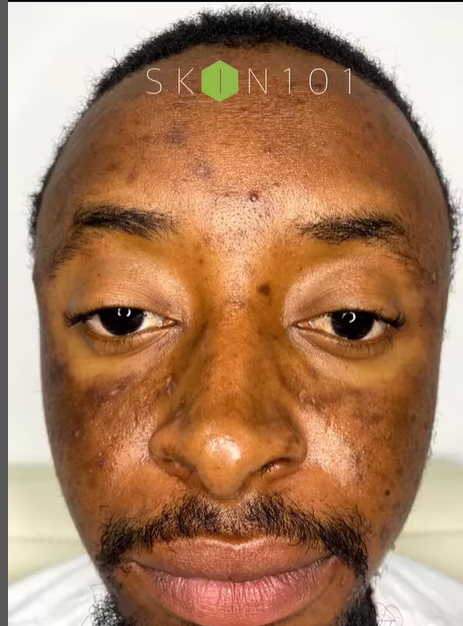 Skin 101 photo 2