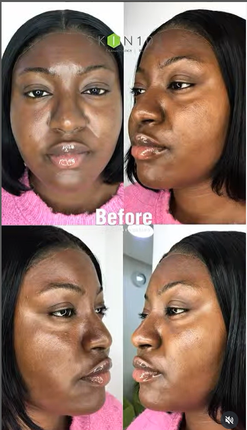 Skin 101 photo 3