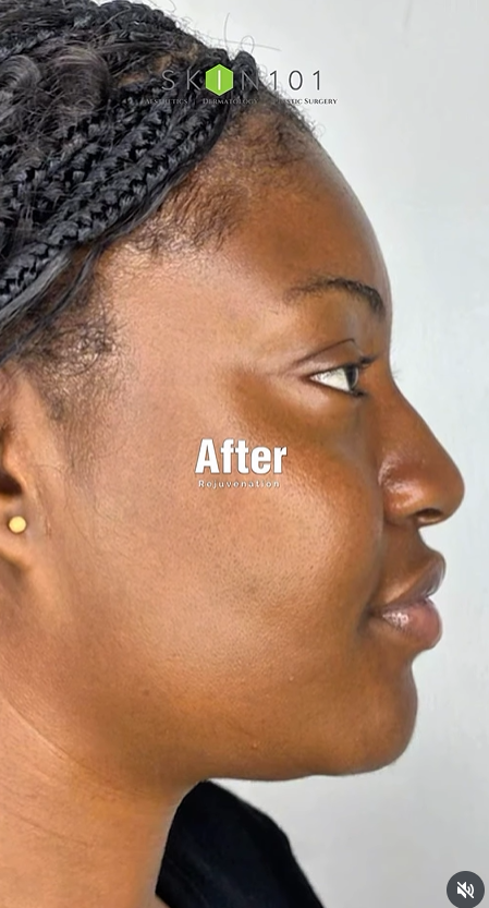 Skin 101 photo 5