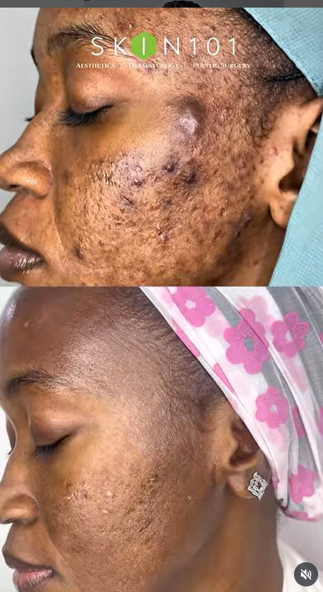 Skin 101 photo 7