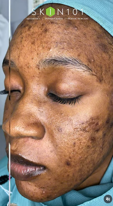 Skin 101 photo 8